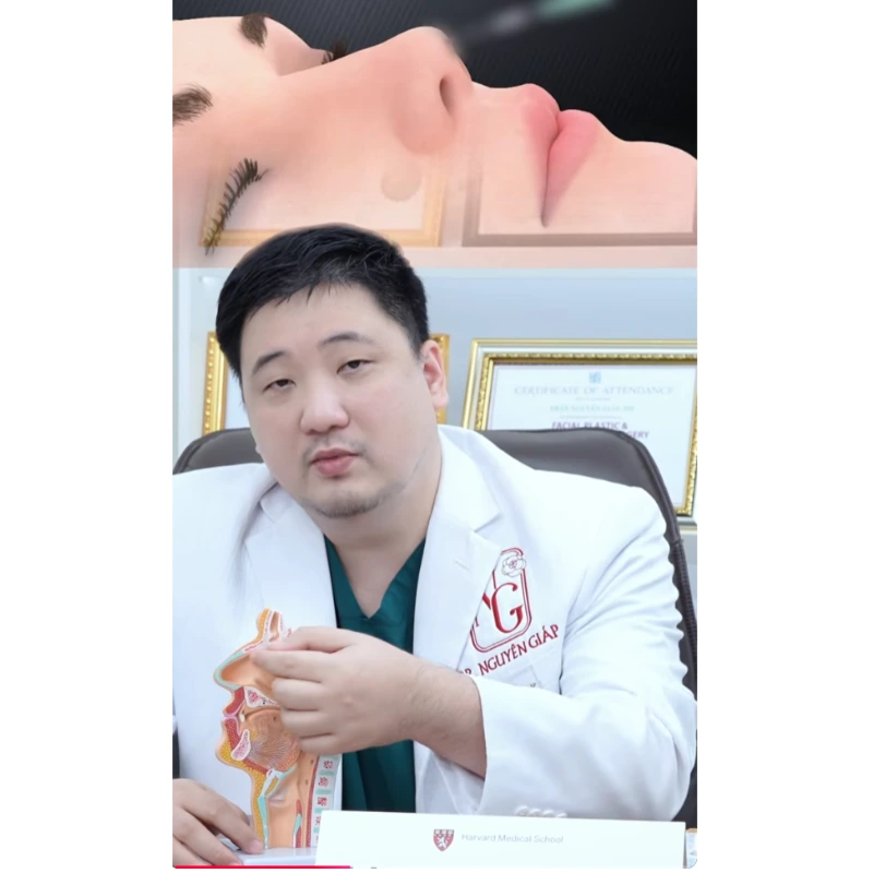 nang-mui-bang-chi-la-gi Rhinoplasty using only what is