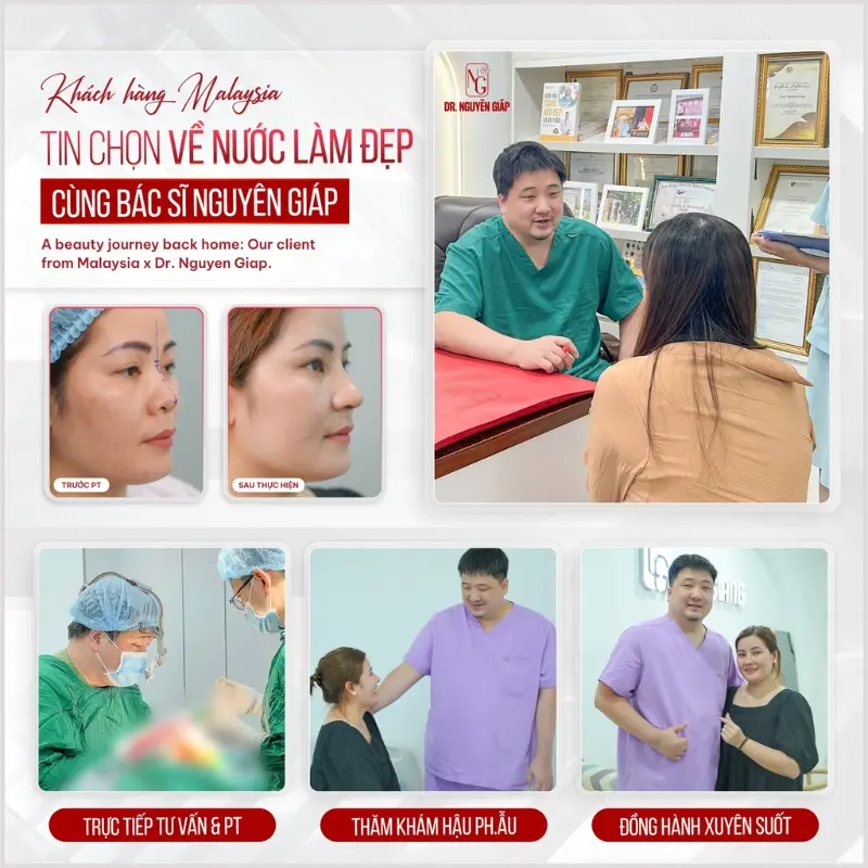 review rhinoplasty at dr. Nguyen Giap